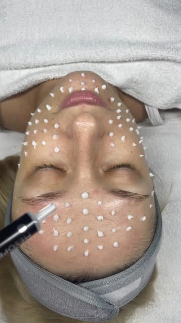Tratament facial în lucru, alb-negru